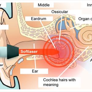 Sudden Onset Tinnitus - American Tinnitus Association - Their Advice