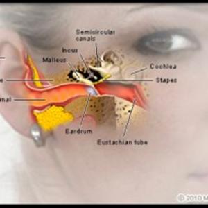 Tinnarex For Tinnitus - Causes Of Tinnitus In One Ear - How To Stop The Noise In Your Ear Quickly